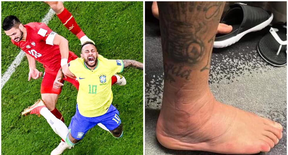 Recuperación en curso: Neymar muestra cómo viene tratando su lesión en el tobillo 