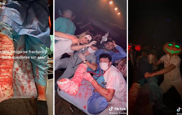 Viral: Young man fractures but friends manage to take him to a party for Halloween