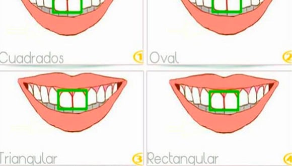 Deberás elegir cuál es la forma de tus dientes que se parece más a los tuyos.| Foto: acertijo en 7 segundos