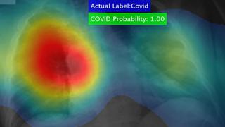 Científico desarrolló un software que produce un diagnóstico de coronavirus en cuestión de segundos