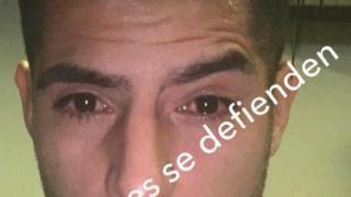 Lamentable: Zambrano mostró cómo quedaron sus ojos tras los incidentes en el Mineirao 