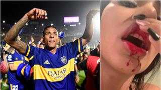Exnovia de Sebastián Villa se confiesa tras denunciar maltratos del jugador: “Perdí un embarazo por los golpes que me había dado”
