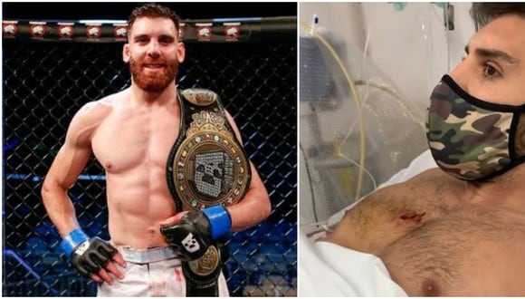Campeón de MMA recibió un balazo en el pecho tras frustrar robo de su moto en Argentina. (Twitter/Instagram)
