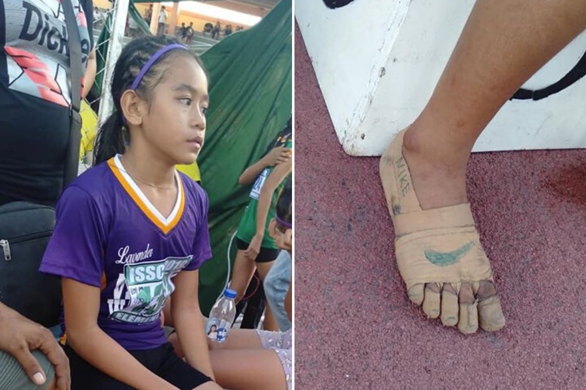 Una niña de 11 años se convirtió en una sensación del Internet al obtener tres medallas de oro en una competencia escolar de atletismo con sus pies envueltos en vendajes. (Foto: Predirick B. Valenzuela en Facebook)