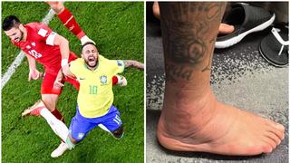 Recuperación en curso: Neymar muestra cómo viene tratando su lesión en el tobillo [FOTO]