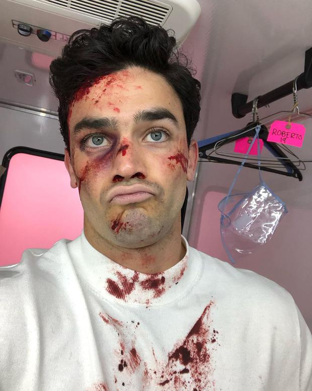 José Manuel Rincón maquillado con sangre falsa para "Senda prohibida” (Foto: José Manuel Rincón / Instagram)