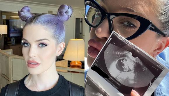 Kelly Osbourne embarazada: hija de Ozzy publica foto de la ecografía de su  bebé en Instagram USA EEUU Estados Unidos Celebs RMMN | OFF-SIDE | DEPOR