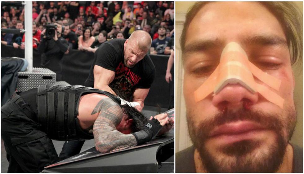 Roman Reigns sufrió la fractura de nariz debido a los salvajes golpes de Triple H. (WWE)