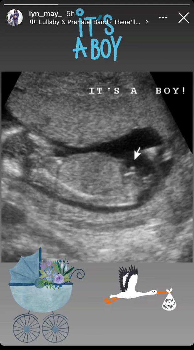 Lyn May tendrá un niño. (Foto: @lyn_may_). 