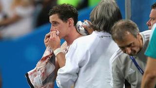 Al quirófano: Rudy es operado de la nariz tras dura patada en el rostro de jugador sueco en el Mundial