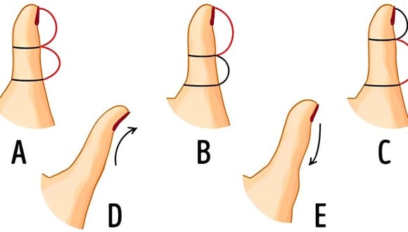 Test visual: la forma de tu dedo pulgar revelará tus virtudes y defectos en esta prueba (Foto: GenialGuru).