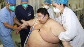 ¡Para no creer! Ciudadano chino engordó 100 kilos durante el confinamiento de Wuhan, en Hubei [FOTO]