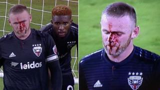 Rooney, en estado de shock: la MLS lo deja lleno de sangre en choque [VIDEO]