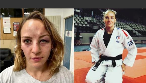 “Pensé que iba a morir”: el duro relato de una judoca olímpica tras sufrir agresión de su pareja. (Twitter)