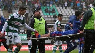 Jugador sufrió fractura de tibia y peroné tras esta durísima falta [VIDEO]