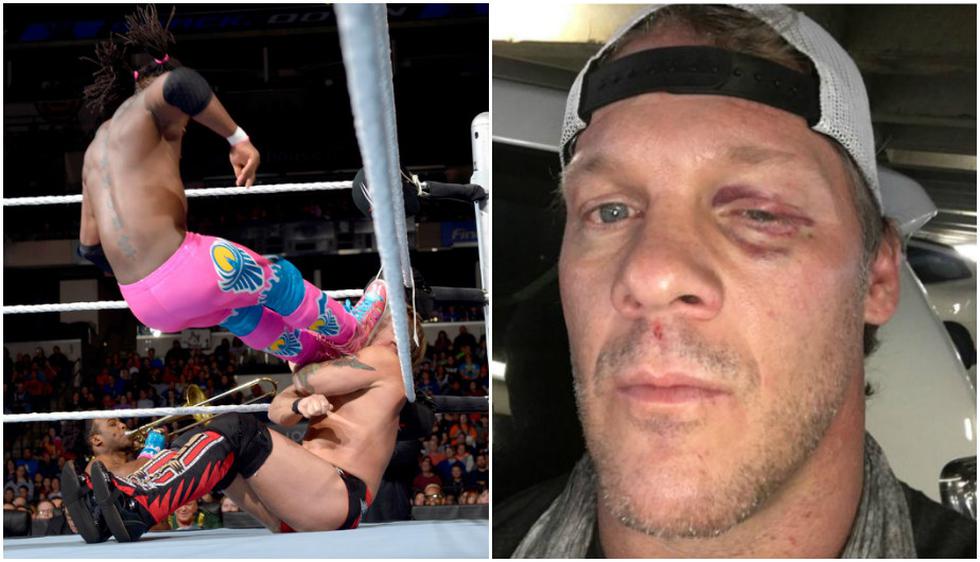 Chris Jericho sufrió lesión a mano de The New Day. (WWE/Instagram)