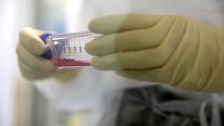 Fueron todo un éxito: anuncian primeras pruebas en Francia de remedio contra el coronavirus 