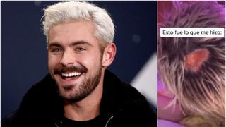 Un resultado de aquellos: quiso quedar como Zac Efron y así quedó