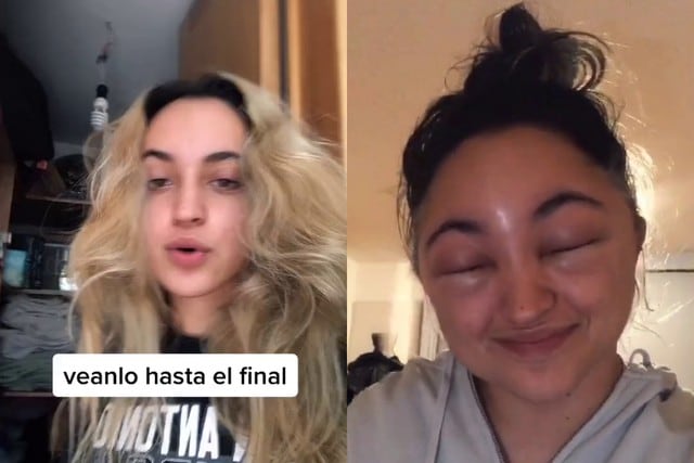 Foto 1 de 5: Los videos virales de una mujer en México muestran lo deformada que quedó su cabeza tras cambiar el color de su cabello. Desliza hacia la derecha para saber cómo terminó así. (Crédito: @mirandaguati en TikTok)