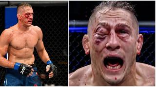 ¡Eso sí debe doler! Así quedó el ojo de Niko Price tras terrible corte en el UFC 249 [VIDEO]