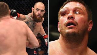 UFC: Matt Mitrione casi pierde el ojo por este golpe de Travis Browne (VIDEO)