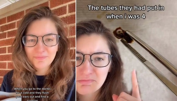 El video viral de una joven que cuenta que le limpiaron los oídos y le encontraron un objeto de hace más de 20 años. (Foto: @dogs_over_ppl / TikTok)