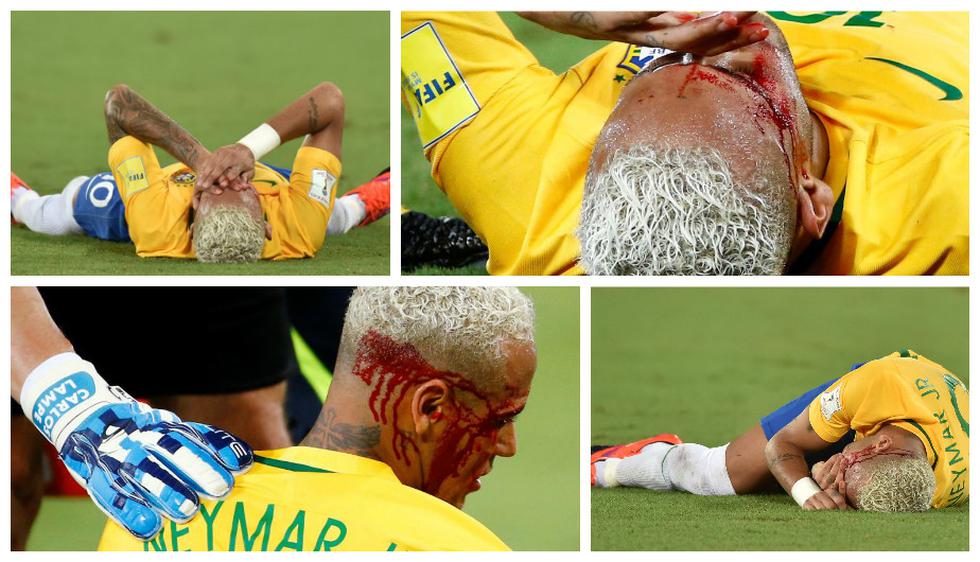 CUADROXCUADRO: Neymar quedó ensangrentado tras esta dura falta en Natal