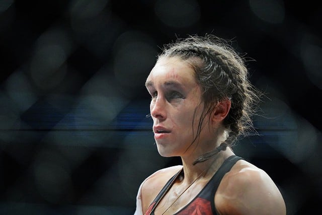 La cara de Joanna Jedrzejczyk luego de su derrota ante Weili Zhang en el UFC 248. (Foto: Getty Images)