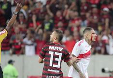 ¡Sangre, sudor y lágrimas! Paolo Guerrero fue expulsado ante Flamengo