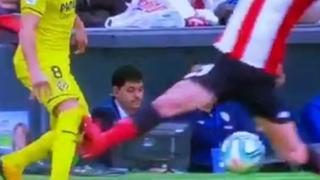 Puede herir susceptibilidades: así quedó la pierna de Santi Cazorla tras el patadón sufrido en el Villarreal-Athletic [FOTO]