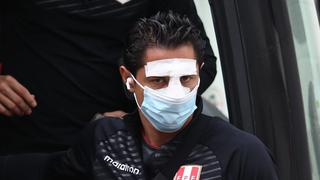 Lapadula llegó con la nariz vendada al entrenamiento de la Selección Peruana 