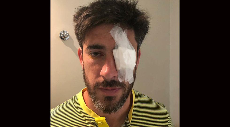 Pablo Pérez y su lesión en el ojo, tras el ataque al bus de Boca Juniors. (Foto: Jorge Batista @jpbatista)