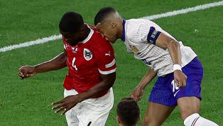 Eurocopa 2024: Conoce lo último sobre la fractura en la nariz de Kylian Mbappé