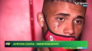 Dejó huella: así quedó la cara de Costa tras el codazo de Zambrano que nadie vio en el Boca vs. Independiente