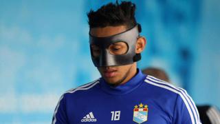¡Jugará con máscara! Christofer Gonzales se apunta para enfrentar a Sport Boys