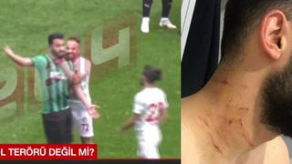 ¡Criminal acción! Futbolista amenazó con una cuchilla a rival y casi le corta la yugular en Turquía [VIDEO]