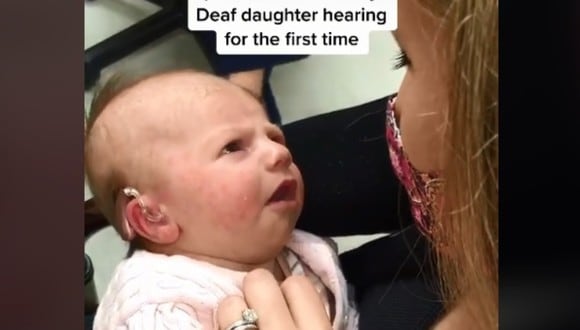Bebé sorda oye por primera vez gracias a un aparato y su emotiva reacción se vuelve viral. (Foto: @christina_pax / TikTok)