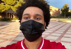 The Weeknd sorprende en redes sociales con transformación en su rostro 