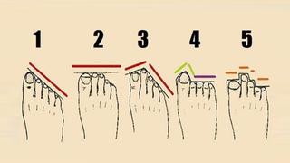 ¿De qué forma son los dedos de tus pies? La respuesta que elijas revelará el lado oculto de tu personalidad
