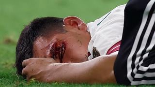 “Podía quedarme paralítico o perder el ojo”: ‘Chucky’ Lozano recuerda lesión en Copa Oro
