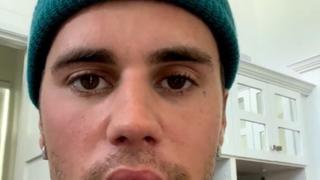 Justin Bieber: ¿Cuánto tiempo estará fuera de los  escenarios por parálisis facial?