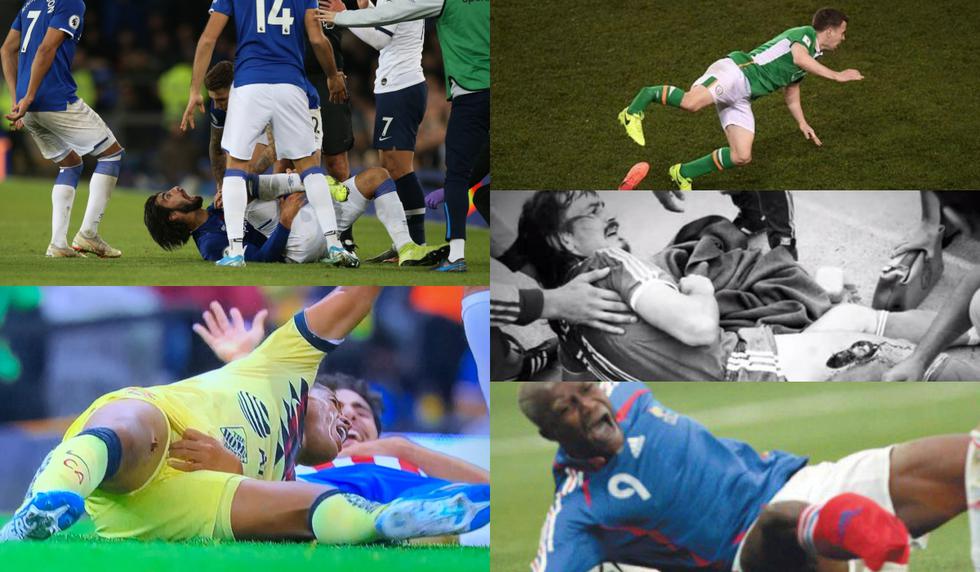 Imágenes pueden herir susceptibilidades: las lesiones más desgarradoras nunca antes vistas en el fútbol [FOTOS]