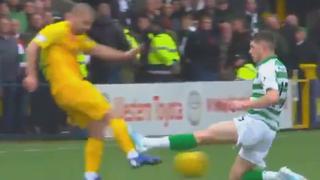 No aguantó la presión: jugador del Celtic borró su Twitter tras casi romperle la pierna a un rival [VIDEO]