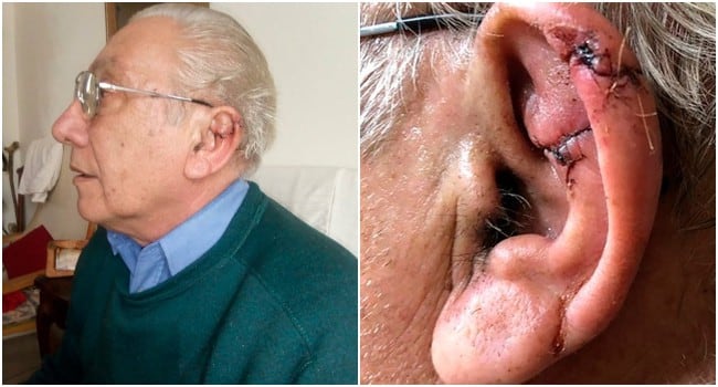 Anciano de 71 años se hizo coser la oreja por un veterinario debido al miedo de contraer el coronavirus. (Fotos: La Brújula 24)