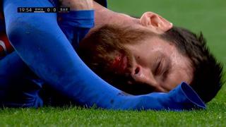 Casi lo noquean: codazo de Marcelo hizo sangrar a Lionel Messi en el Clásico [VIDEO]