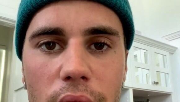 Justin Bieber explica a sus seguidores sobre la dolencia que padece (Foto: @justinbieber Instagram)