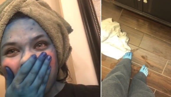 Una joven terminó con la piel de color azul tras cometer un terrible error mientras se teñía el cabello. (Foto: @kinsey_dixon / TikTok)