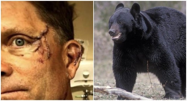 Hombre recibió feroz ataque de un oso negro que se encontraba en su cocina en plena madrugada. (Fotos: ABC News)