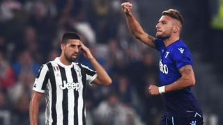 Adiós al invicto: Juventus perdió 2-1 ante Lazio por la fecha 8 de la Serie A en el Allianz Stadium de Turín