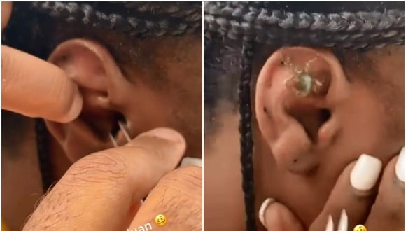 Una mujer comparte el momento en que le quitan un cangrejo atascado de la oreja. (Foto: @wesdaisy)